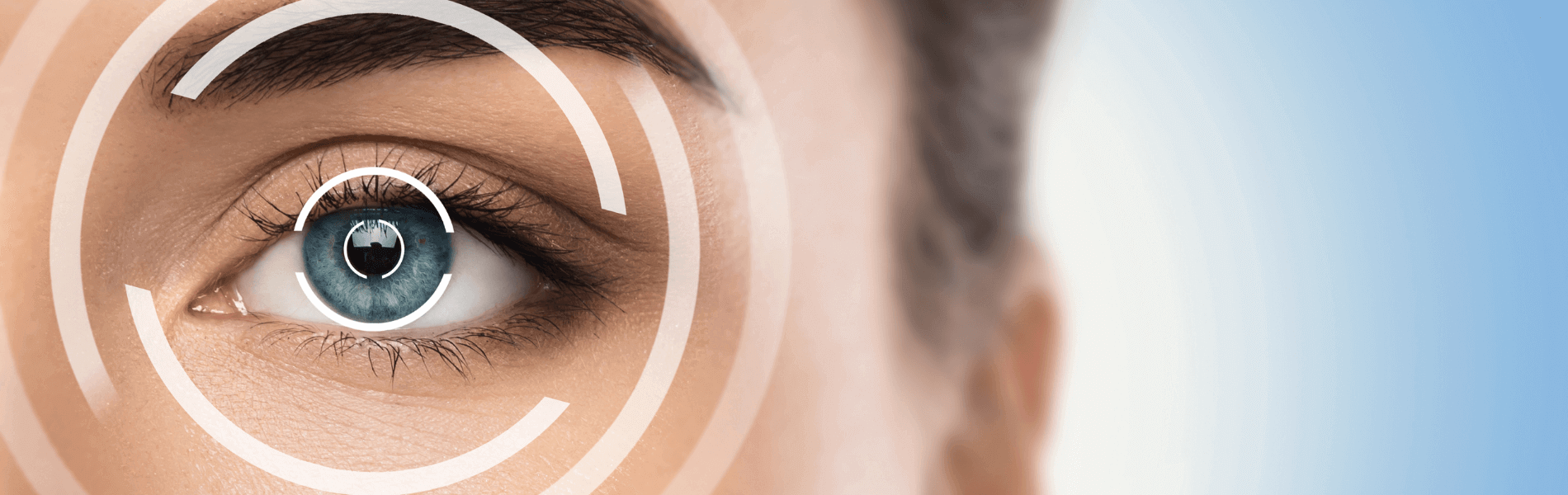 Myopia Control